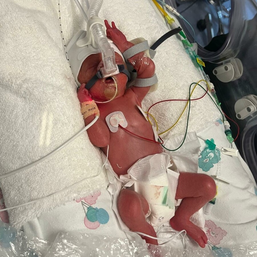 Addison nicu